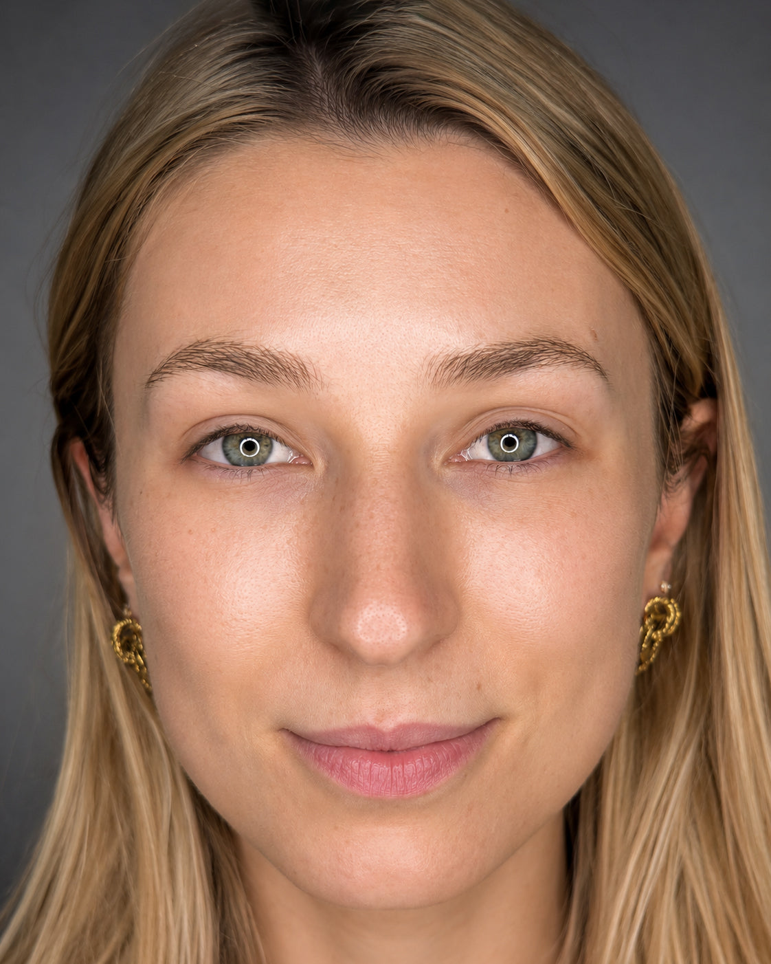 image comparison after