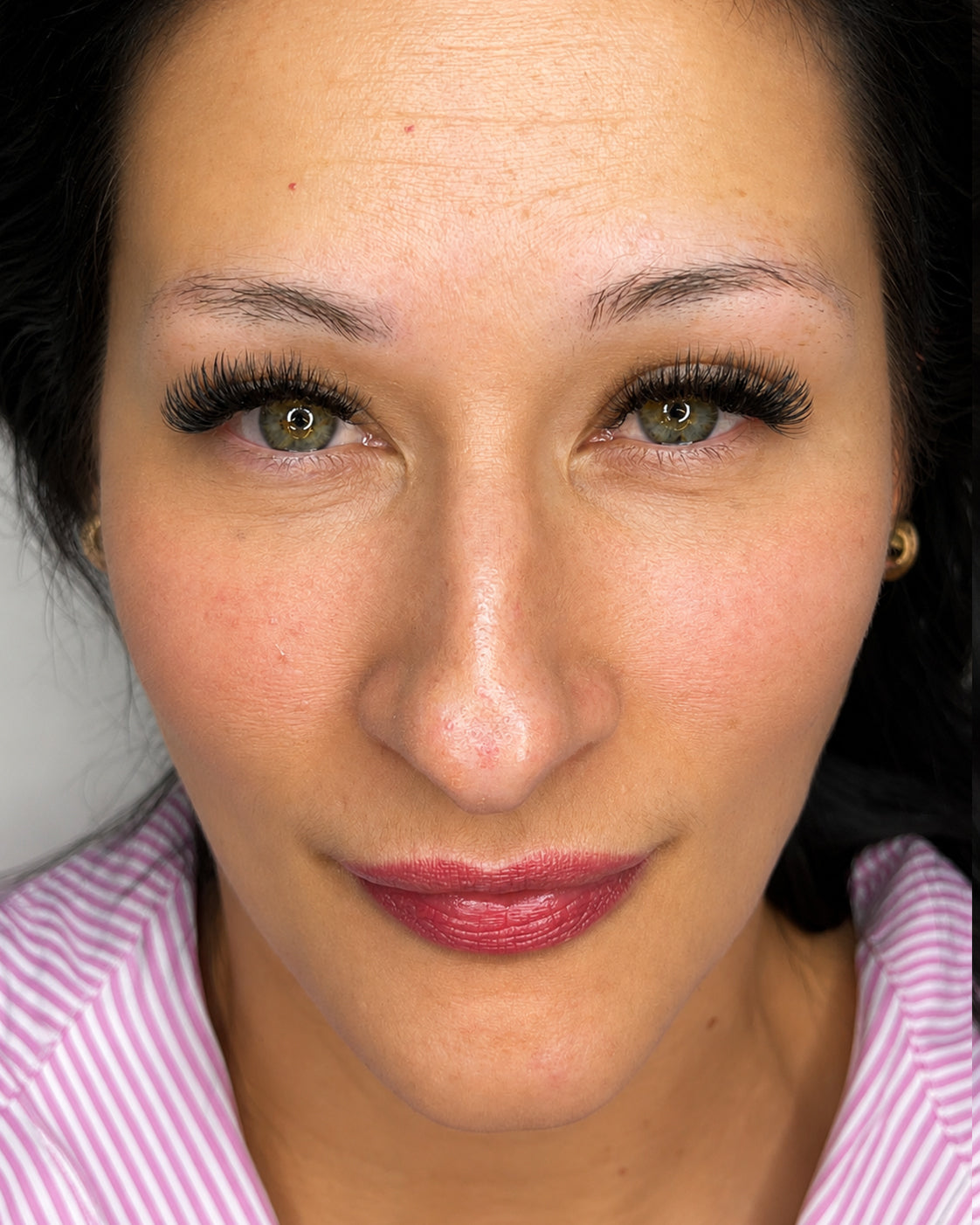 image comparison before